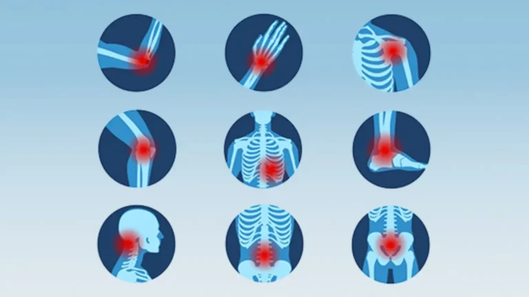 How Do Autoimmune Diseases Develop? The Body’s Betrayal Explained